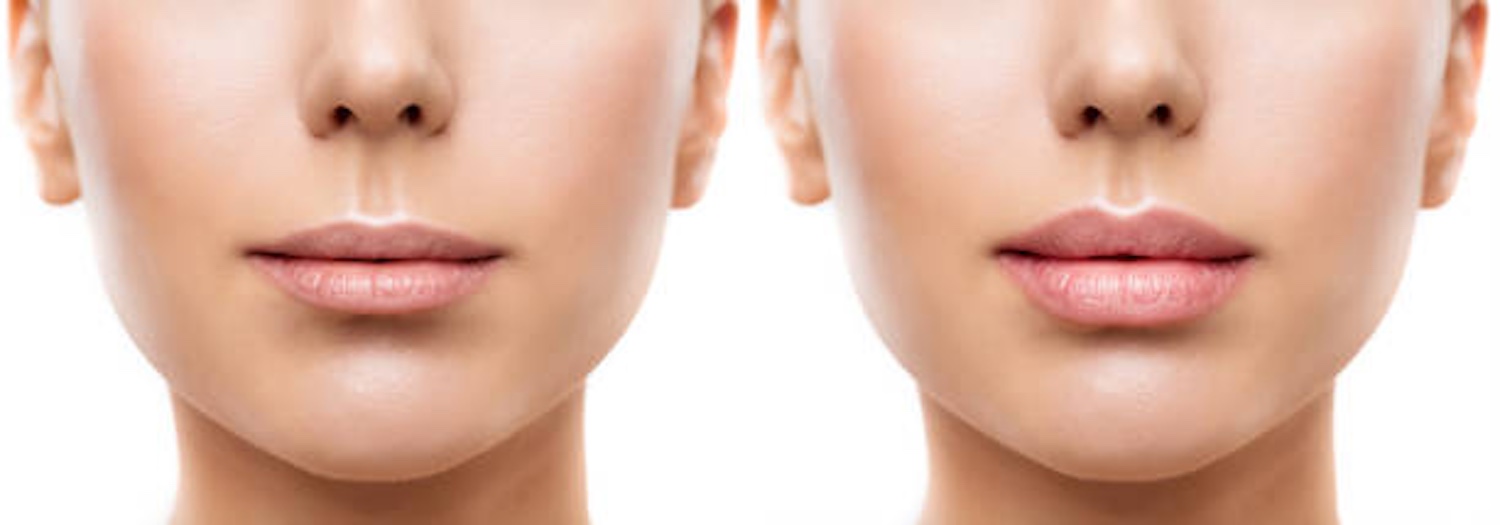 Maquillage permanent lèvres By Guillaume avant après
